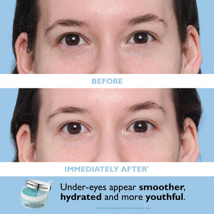 Peter Thomas Roth Water Drench® Essentials 2-Piece Face & Eye Kit – Hyaluronic Acid Moisturizer & Eye Masks Avelisse