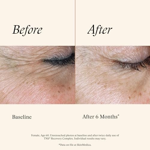 SkinMedica TNS Recovery Complex Facial Treatment - Advanced Growth Factor & Exosome Serum for Skin Rejuvenation, Fine Lines & Wrinkles, 1 oz Avelisse