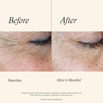 SkinMedica TNS Recovery Complex Facial Treatment - Advanced Growth Factor & Exosome Serum for Skin Rejuvenation, Fine Lines & Wrinkles, 1 oz Avelisse
