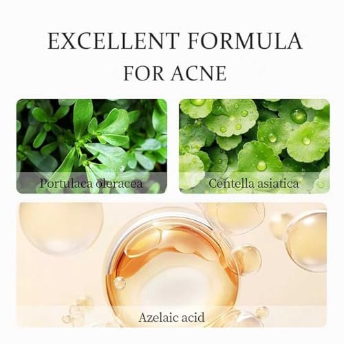 20% Azelaic Acid Cream with Hyaluronic Acid - Soothing Face Moisturizer for Redness, Acne, and Excess Oil - görsel 6