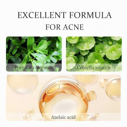 20% Azelaic Acid Cream with Hyaluronic Acid - Soothing Face Moisturizer for Redness, Acne, and Excess Oil