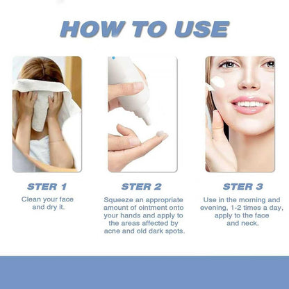 20% Azelaic Acid Cream with Hyaluronic Acid - Soothing Face Moisturizer for Redness, Acne, and Excess Oil