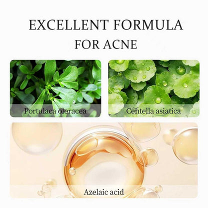 20% Azelaic Acid Cream with Hyaluronic Acid - Soothing Face Moisturizer for Redness, Acne, and Excess Oil