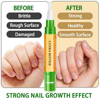 Econail 3-in-1 Nail Biting Prevention Kit for Kids & Adults - Extra Strength Bitter Polish + Gentle Bitter Polish + Cuticle Oil, Fast Drying Formula Stops Nail Biting & Thumb Sucking (0.3 Fl Oz, Pack of 1)