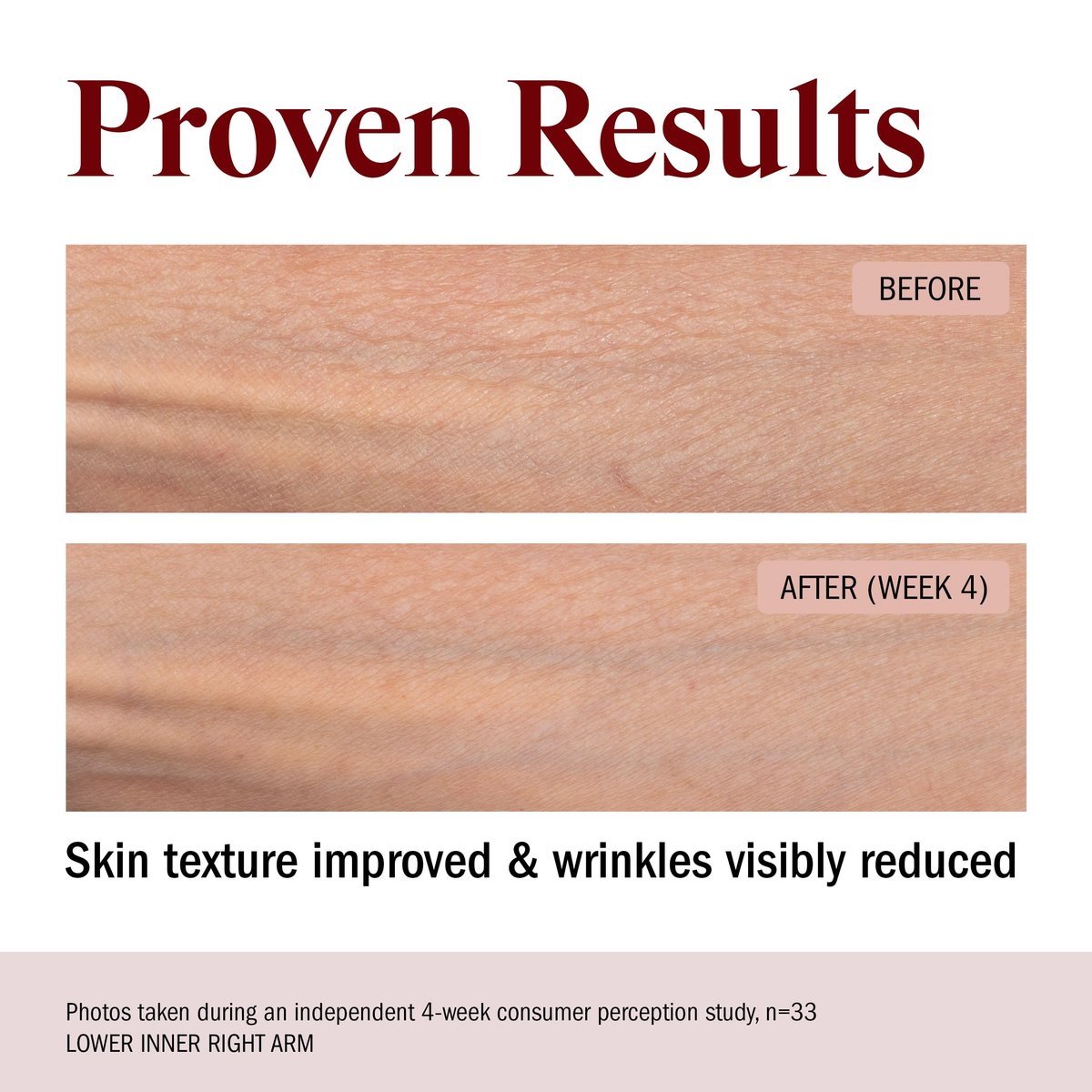 STRIPES Beauty Rich & Tight Ultra Hydrating & Firming Peptide Body Butter with Ectoine and Squalane, 16.48 oz Avelisse