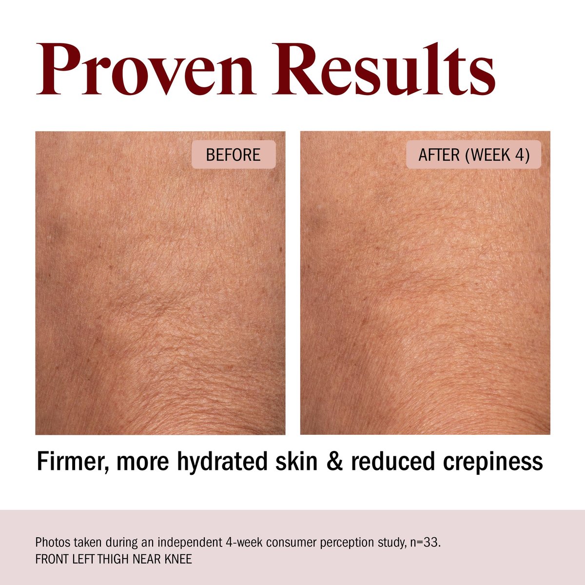 STRIPES Beauty Rich & Tight Ultra Hydrating & Firming Peptide Body Butter with Ectoine and Squalane, 16.48 oz Avelisse
