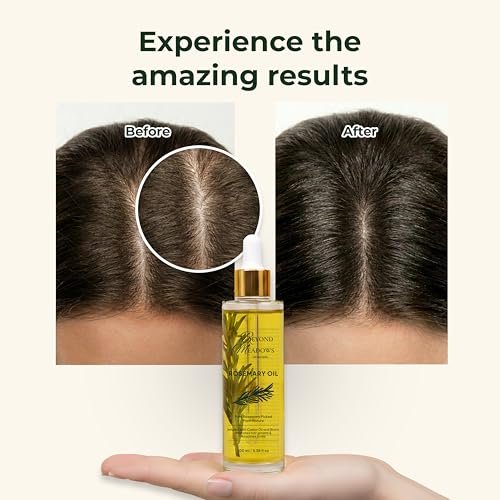 Beyond Meadows Organic Rosemary Oil for Hair Growth – Infused with Biotin, Castor Oil & Peppermint for Healthier Hair & Stronger Roots, Split Ends & Dry Scalp Treatment - with Dropper (3.38 fl oz) Avelisse