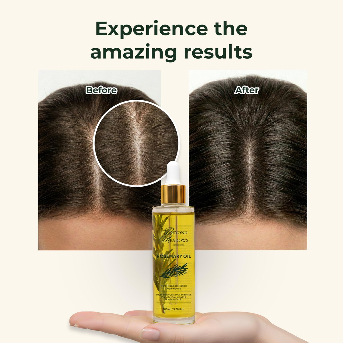 Beyond Meadows Organic Rosemary Oil for Hair Growth – Infused with Biotin, Castor Oil & Peppermint for Healthier Hair & Stronger Roots, Split Ends & Dry Scalp Treatment - with Dropper (3.38 fl oz) Avelisse