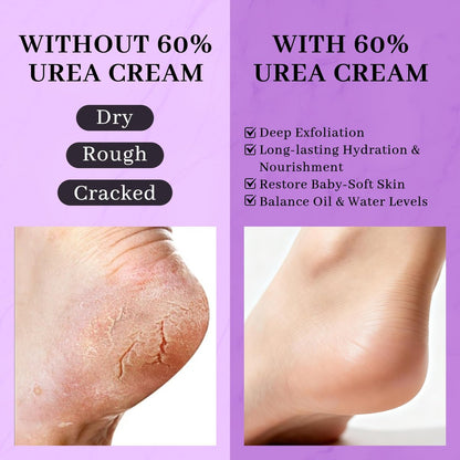 Clyecfra 5-in-1 60% Urea Cream with 2% Salicylic Acid – Maximum Strength Moisturizer for Rough, Dry, Thick & Cracked Skin, Callus Remover, Deep Hydration, 150g