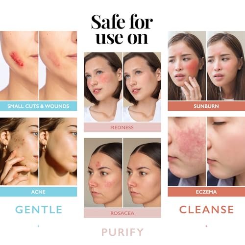 Aquia Hypochlorous Acid Spray for Face and Skin - 32oz Refill Face Mist, Antimicrobial Facial Cleanser for Acne, Eczema, Rash, and Wound Care Avelisse