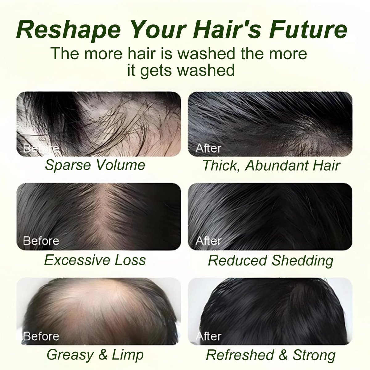 Tgideas Batana Oil & Rosemary Shampoo for Hair Growth, Formula for Thinning Hair & Reduce Hair Loss, Nourish Scalp & Add Volume, for Men & Women (Pack of 2) Avelisse