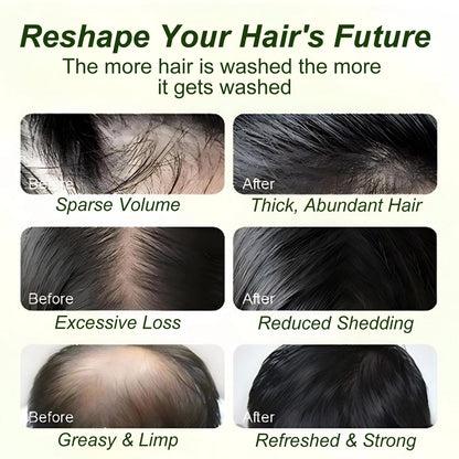Tgideas Batana Oil & Rosemary Shampoo for Hair Growth, Formula for Thinning Hair & Reduce Hair Loss, Nourish Scalp & Add Volume, for Men & Women (Pack of 2) Avelisse