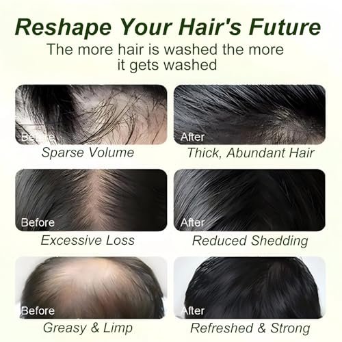 Tgideas Batana Oil & Rosemary Shampoo for Hair Growth, Formula for Thinning Hair & Reduce Hair Loss, Nourish Scalp & Add Volume, for Men & Women (Pack of 2) Avelisse