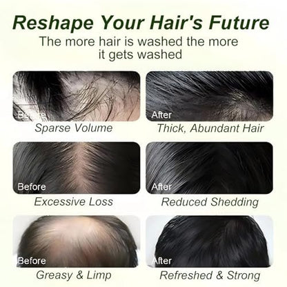 Tgideas Batana Oil & Rosemary Shampoo for Hair Growth, Formula for Thinning Hair & Reduce Hair Loss, Nourish Scalp & Add Volume, for Men & Women (Pack of 2) Avelisse