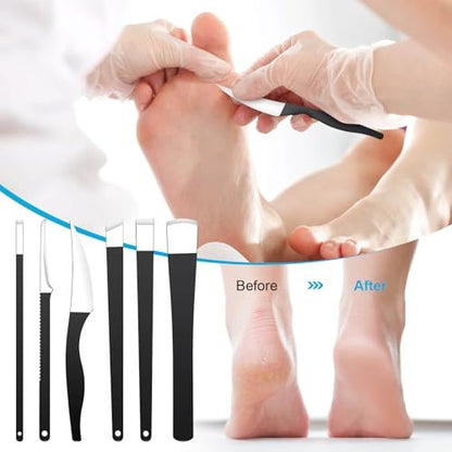 Professional 6-Piece Pedicure Knife Set – Stainless Steel Ingrown Toenail Removal & Foot Care Tools