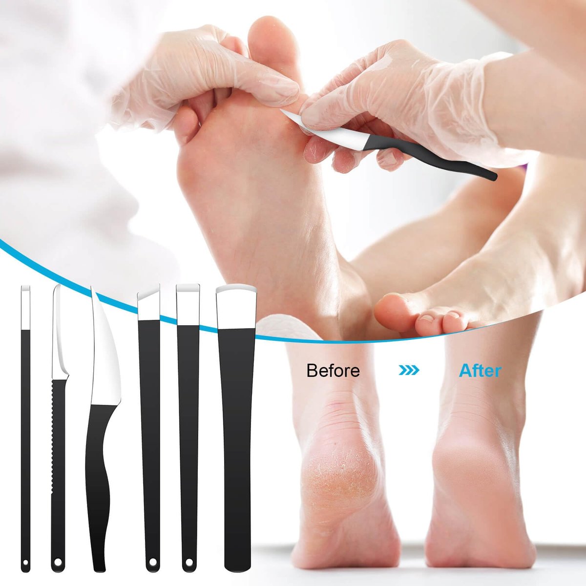 Professional 6-Piece Pedicure Knife Set – Stainless Steel Ingrown Toenail Removal & Foot Care Tools - görsel 5