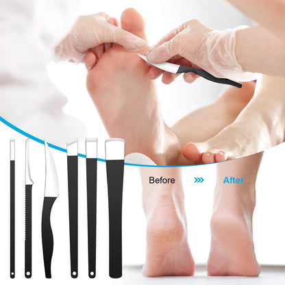 Professional 6-Piece Pedicure Knife Set – Stainless Steel Ingrown Toenail Removal & Foot Care Tools