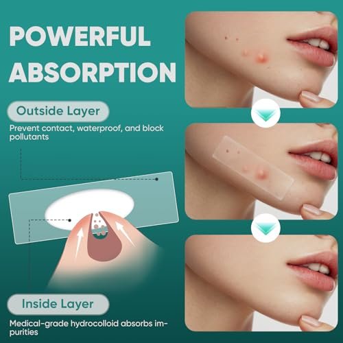 Kindshine 96 Count XL Pimple Patches - Hydrocolloid Acne Patches for Face & Body, Vegan Cruelty-Free Blemish Spot Stickers, Invisible Zit Covers for Chin, Back, Forehead - görsel 9