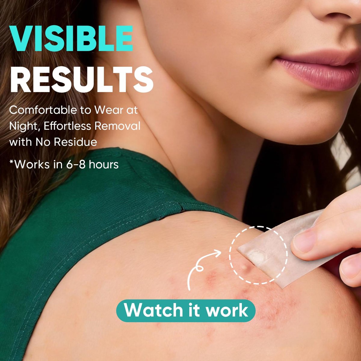 Kindshine 96 Count XL Pimple Patches - Hydrocolloid Acne Patches for Face & Body, Vegan Cruelty-Free Blemish Spot Stickers, Invisible Zit Covers for Chin, Back, Forehead - görsel 6