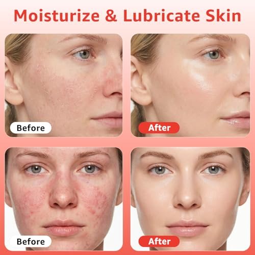 Fymiox Red Light Therapy Serum - Activating Face Serum with Vitamin E & Rose Extract for Enhanced Red Light Therapy Effects, Reduces Wrinkles, Hydrating, 1 Fl Oz Avelisse