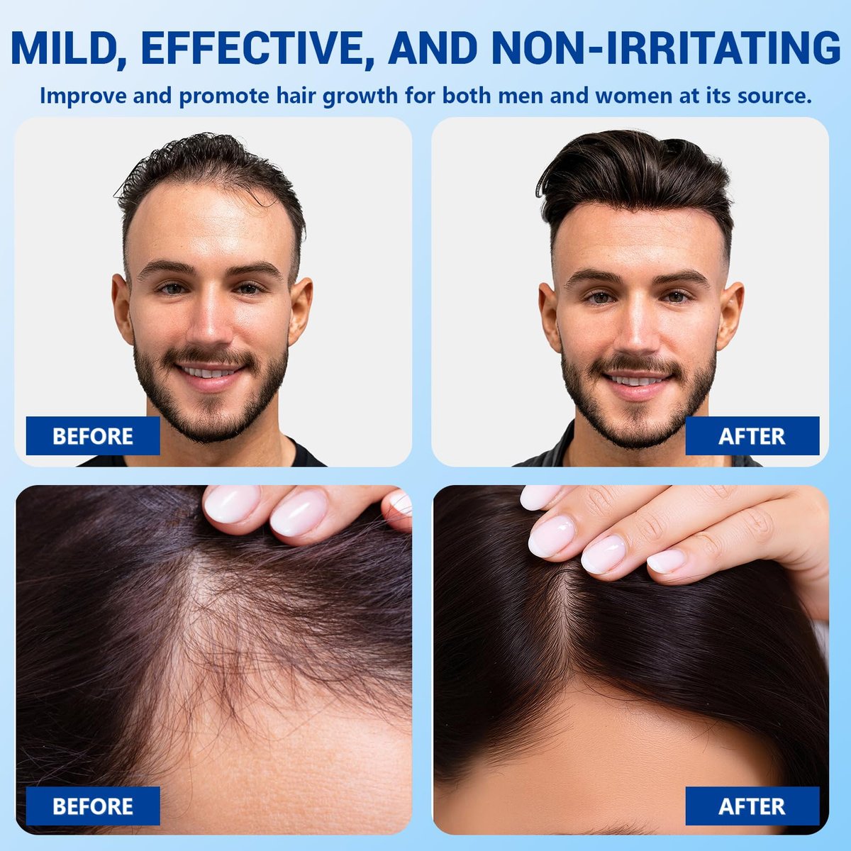 YUFUY Hair Growth Serum Roll On – 3% Batana & Castor Oil, 2% Biotin & Niacinamide, 3% Rosemary Oil for Thinning Hair – No-Rinse, Fast-Absorbing Scalp Serum for Men & Women – 1.0 Fl Oz (30 ml) - görsel 5