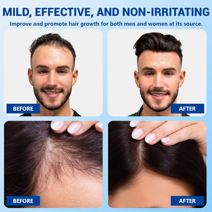YUFUY Hair Growth Serum Roll On – 3% Batana & Castor Oil, 2% Biotin & Niacinamide, 3% Rosemary Oil for Thinning Hair – No-Rinse, Fast-Absorbing Scalp Serum for Men & Women – 1.0 Fl Oz (30 ml)