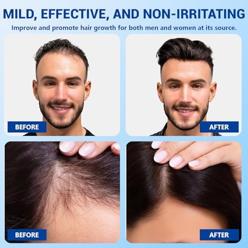 YUFUY Hair Growth Serum Roll On – 3% Batana & Castor Oil, 2% Biotin & Niacinamide, 3% Rosemary Oil for Thinning Hair – No-Rinse, Fast-Absorbing Scalp Serum for Men & Women – 1.0 Fl Oz (30 ml) - görsel 6