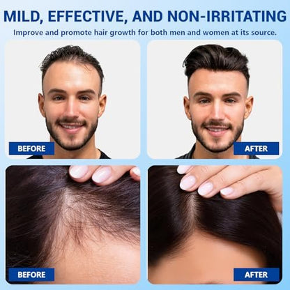YUFUY Hair Growth Serum Roll On – 3% Batana & Castor Oil, 2% Biotin & Niacinamide, 3% Rosemary Oil for Thinning Hair – No-Rinse, Fast-Absorbing Scalp Serum for Men & Women – 1.0 Fl Oz (30 ml)