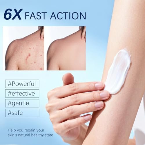 OUHENGTEK Folliculitis Cream - Soothes & Helps Clear Bumps on Scalp, Face, Body & Butt - for Ingrown Hairs, Razor Bumps & Acne - 120g - görsel 8