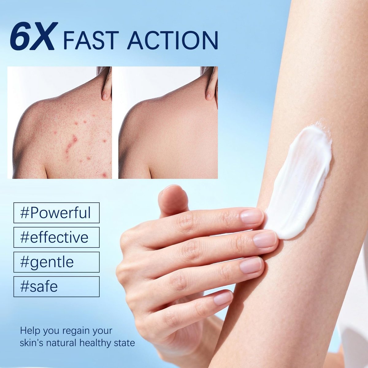 OUHENGTEK Folliculitis Cream - Soothes & Helps Clear Bumps on Scalp, Face, Body & Butt - for Ingrown Hairs, Razor Bumps & Acne - 120g - görsel 7