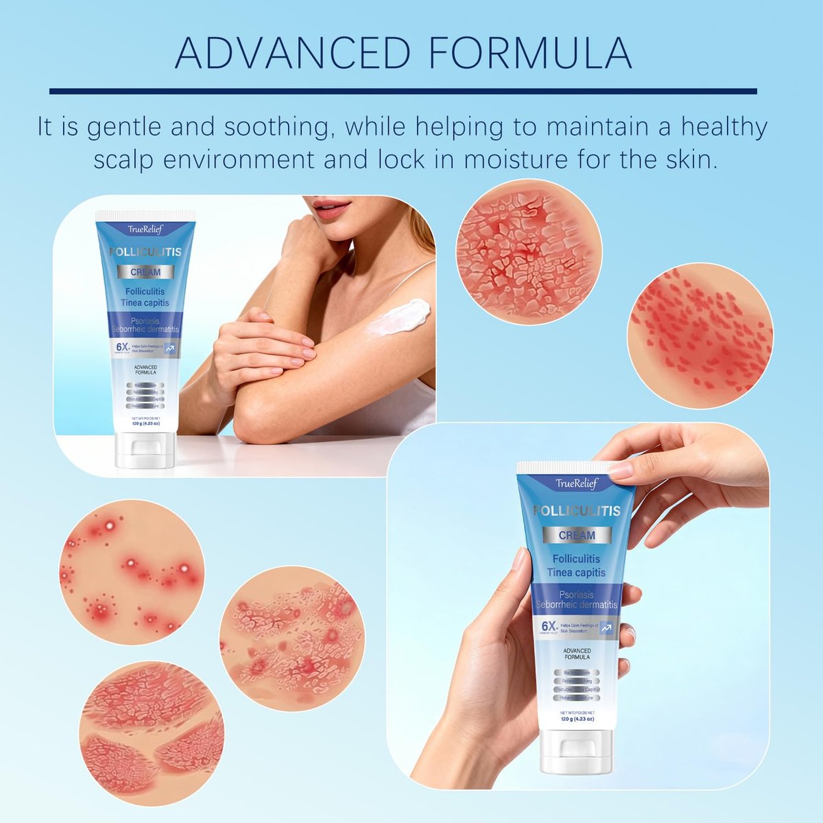 OUHENGTEK Folliculitis Cream - Soothes & Helps Clear Bumps on Scalp, Face, Body & Butt - for Ingrown Hairs, Razor Bumps & Acne - 120g - görsel 13