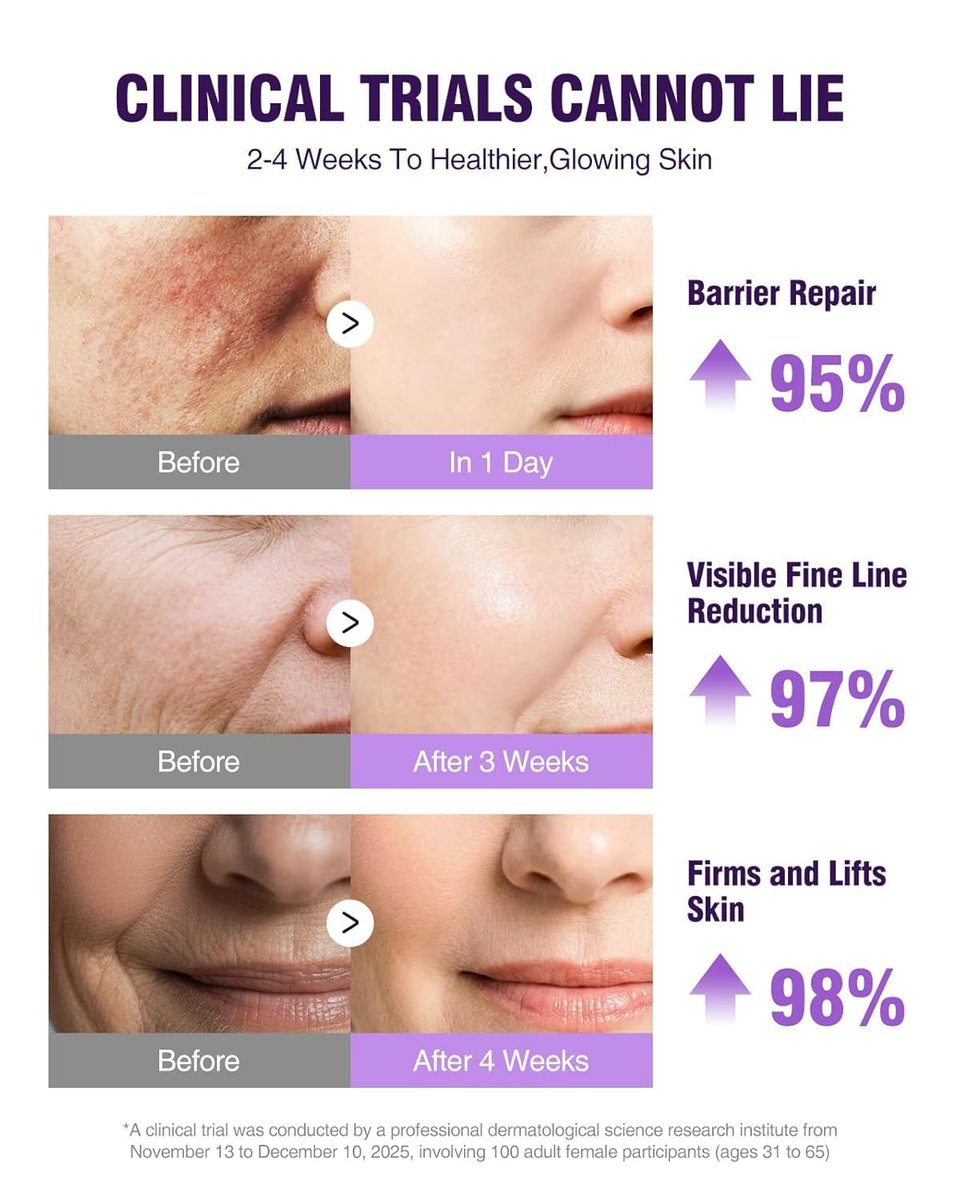 NAD+ Retinol Collagen Face Serum: Anti-Aging Peptide Serum for Tightening Skin, Reducing Wrinkles & Fine Lines, Hydrating for Radiant Glow Avelisse