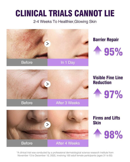 NAD+ Retinol Collagen Face Serum: Anti-Aging Peptide Serum for Tightening Skin, Reducing Wrinkles & Fine Lines, Hydrating for Radiant Glow Avelisse