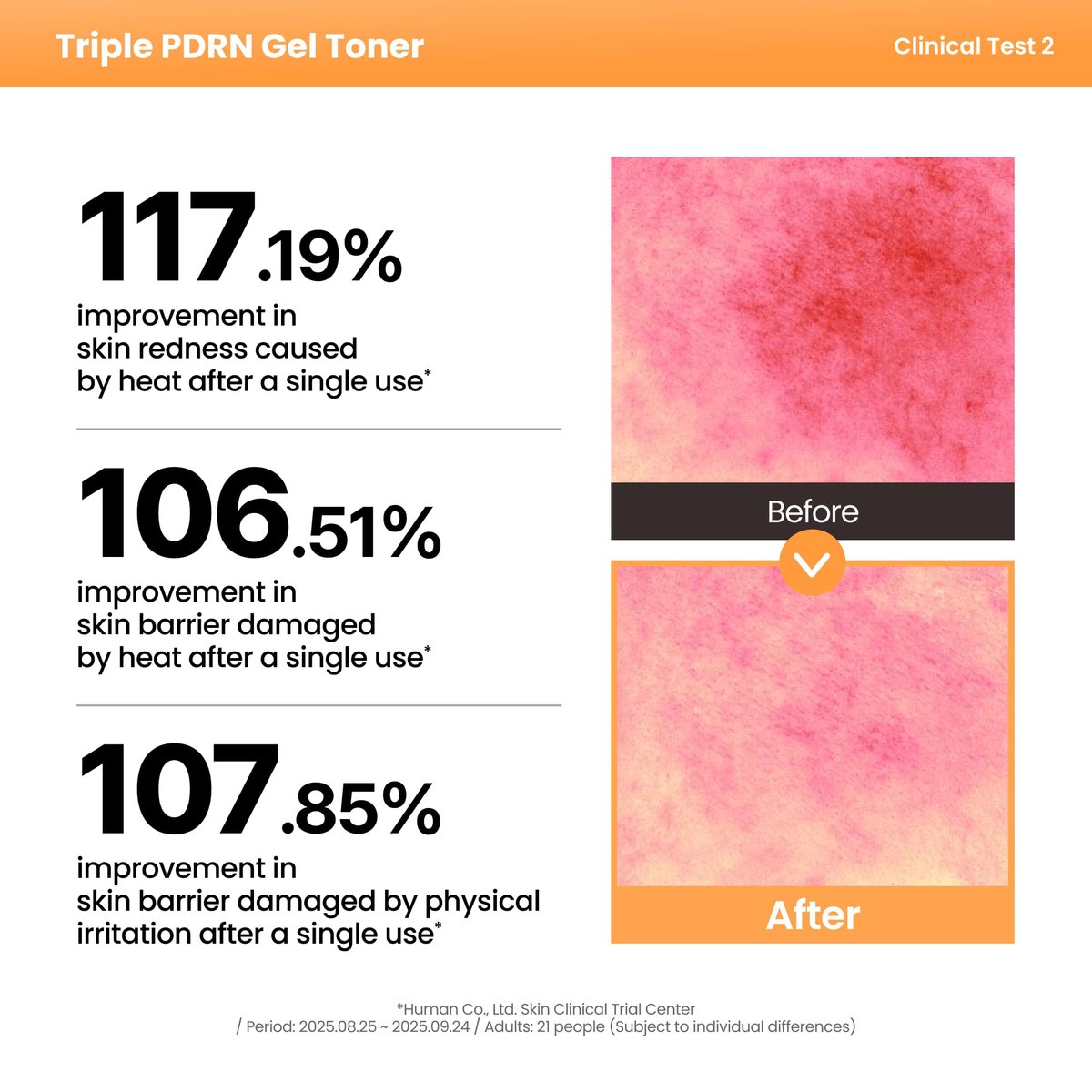 AXIS-Y Triple PDRN Gel Toner – Hydrating Korean Toner with Vegan PDRN, Astaxanthin, Collagen & Peptides – Soothing, Moisture Barrier Repair & Firming Skincare (9.13 fl. oz.) Avelisse