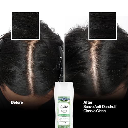 Suave Anti Dandruff 2-in-1 Shampoo & Conditioner for Women, Classic Clean, 1% Pyrithione Zinc Dandruff Treatment, Controls Flakes, Itch & Dry Scalp, 12.6 FL OZ - görsel 10