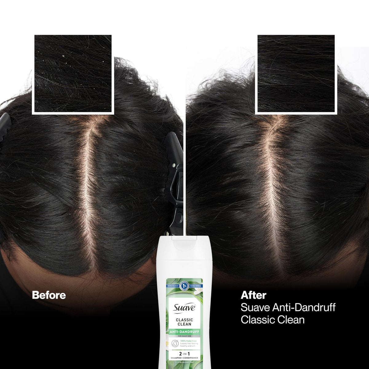 Suave Anti Dandruff 2-in-1 Shampoo & Conditioner for Women, Classic Clean, 1% Pyrithione Zinc Dandruff Treatment, Controls Flakes, Itch & Dry Scalp, 12.6 FL OZ - görsel 9