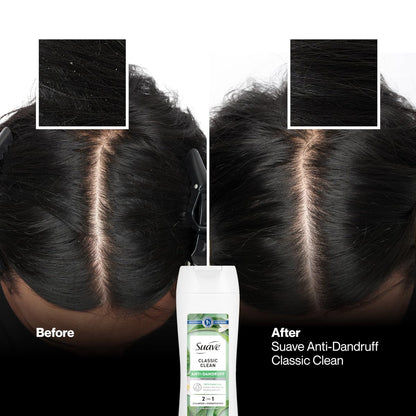 Suave Anti Dandruff 2-in-1 Shampoo & Conditioner for Women, Classic Clean, 1% Pyrithione Zinc Dandruff Treatment, Controls Flakes, Itch & Dry Scalp, 12.6 FL OZ
