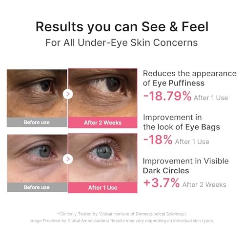 medicube PDRN Caffeine Collagen Eye Patch – 30 Pairs | Gel Eye Patches for Dark Circles, Undereye Bags & Firming Age-Defying Care with Retinol, Collagen | Korean Skincare Avelisse
