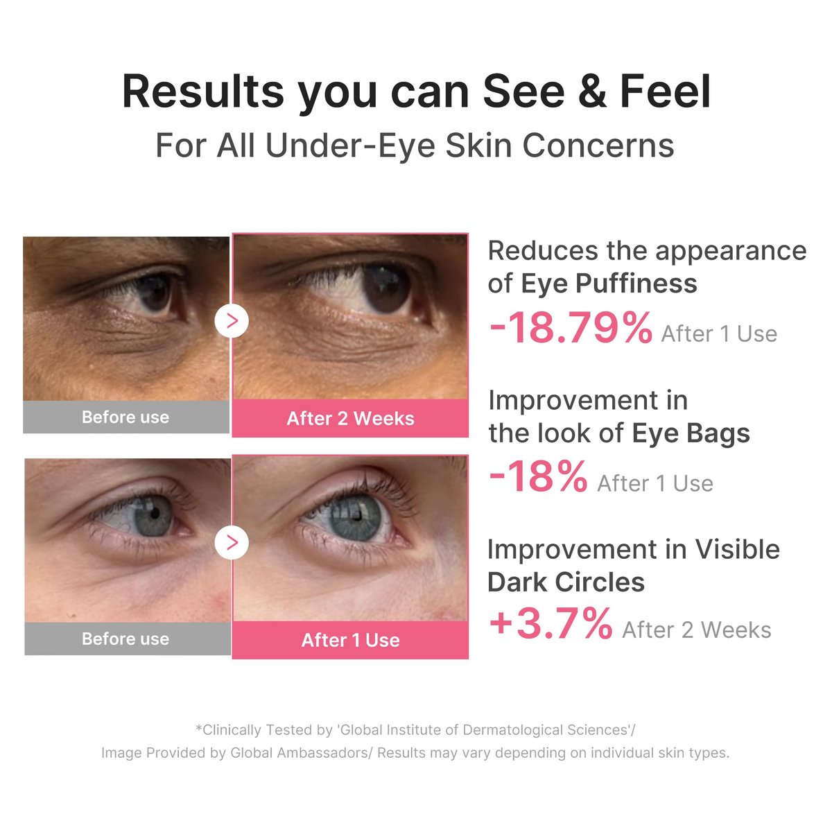 medicube PDRN Caffeine Collagen Eye Patch – 30 Pairs | Gel Eye Patches for Dark Circles, Undereye Bags & Firming Age-Defying Care with Retinol, Collagen | Korean Skincare Avelisse
