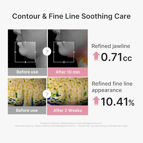 medicube PDRN Pink Tension Up Mask – 3-Step V-Line Sheet Mask for Contoured Chin & Jawline, Full-Face Firming with Salmon PDRN, NAD & Caffeine, Korean Skincare, 34g x 4ea + Tightening Band Avelisse