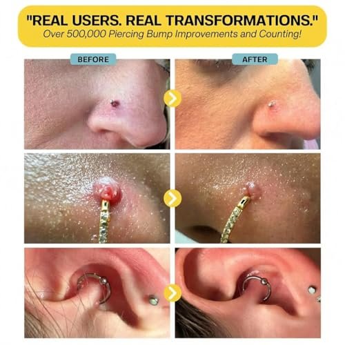 2-Step Piercing Bump Solution: Treatment Oil + Keloid Bump Removal Gel – Professional Aftercare for Nose, Ear & Body Piercings | Effectively Shrinks & Softens Bumps and Scars Avelisse