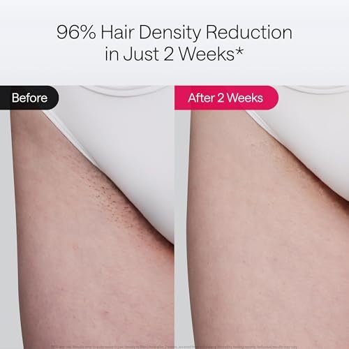 Ulike Air 10 Deluxe Edition IPL Laser Hair Removal Device for Women and Men – Ice-Cooling Technology, Nearly Painless & Permanent Hair Reduction at Home in 10 Minutes Avelisse