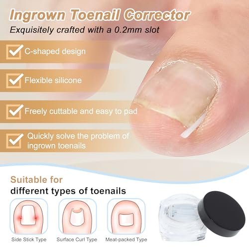 VOCOSTE Ingrown Toenail Correction Kit – Professional Toe Nail Corrector Tools with Leather Case for Curved & Ingrown Nails, Includes Nail Files, Clipper & Lifter Avelisse