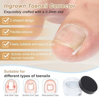 VOCOSTE Ingrown Toenail Correction Kit – Professional Toe Nail Corrector Tools with Leather Case for Curved & Ingrown Nails, Includes Nail Files, Clipper & Lifter Avelisse