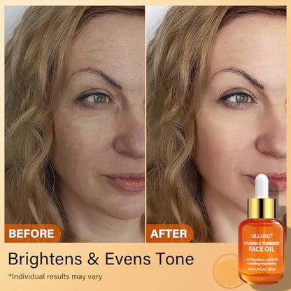 Vitamin C Turmeric Face Oil - Brightening & Hydrating Facial Oil with Jojoba Oil & Squalane for Dark Spots, Dry Skin, Wrinkles & Uneven Skin Tone, All Skin Types, 1 Fl Oz Avelisse