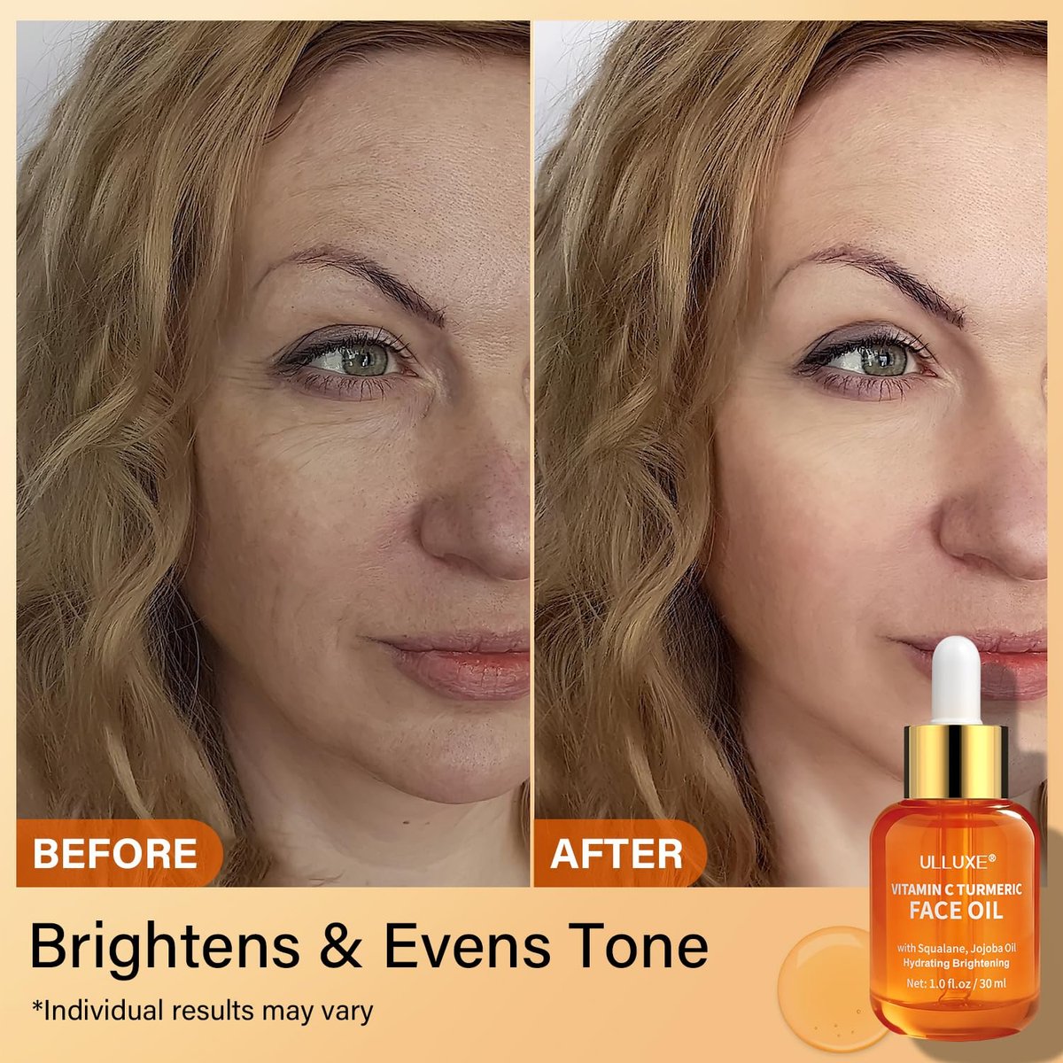 Vitamin C Turmeric Face Oil - Brightening & Hydrating Facial Oil with Jojoba Oil & Squalane for Dark Spots, Dry Skin, Wrinkles & Uneven Skin Tone, All Skin Types, 1 Fl Oz Avelisse