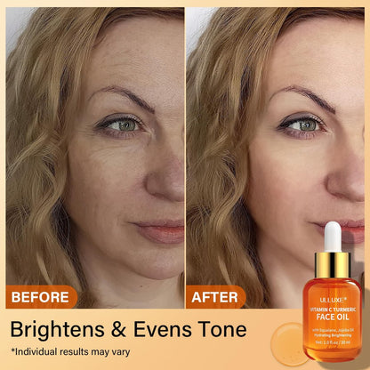 Vitamin C Turmeric Face Oil - Brightening & Hydrating Facial Oil with Jojoba Oil & Squalane for Dark Spots, Dry Skin, Wrinkles & Uneven Skin Tone, All Skin Types, 1 Fl Oz Avelisse