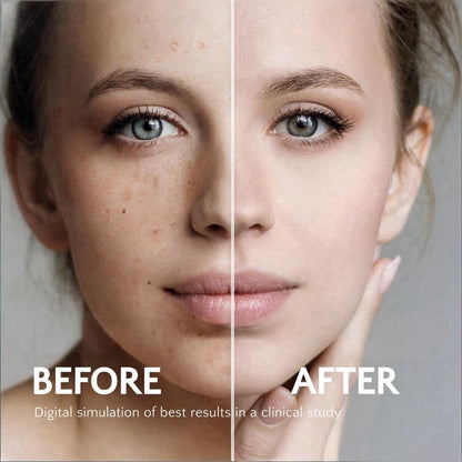 Rivocoda Hydraquinon0l Dark Spot Brightening Cream - 4% Bleaching Cream, Non-Irritating Hydrating Face Moisturizer for All Skin Types, 1oz Avelisse