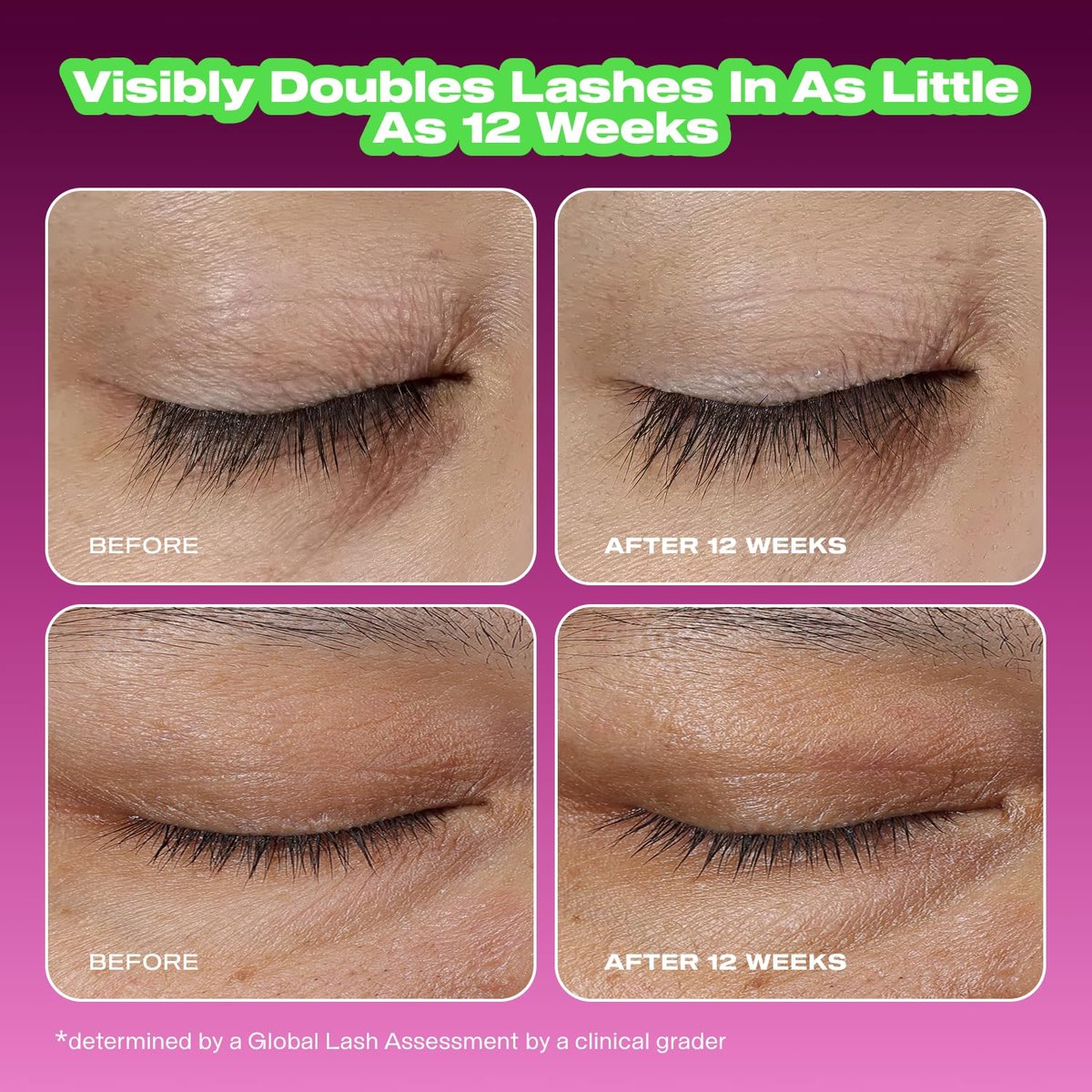 Educated Mess Grow A Pair Lash & Brow Enhancing Serum – Prostaglandin-Free, Non-Irritating Formula (5 ml / 0.17 fl oz) Avelisse
