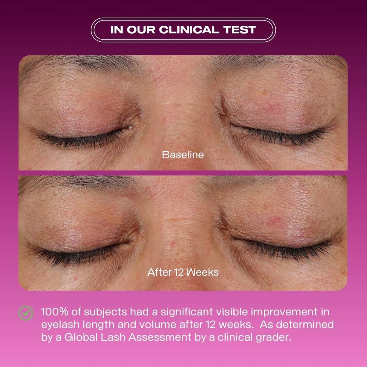 Educated Mess Grow A Pair Lash & Brow Enhancing Serum – Prostaglandin-Free, Non-Irritating Formula (5 ml / 0.17 fl oz) Avelisse
